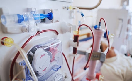 Dialysis machine